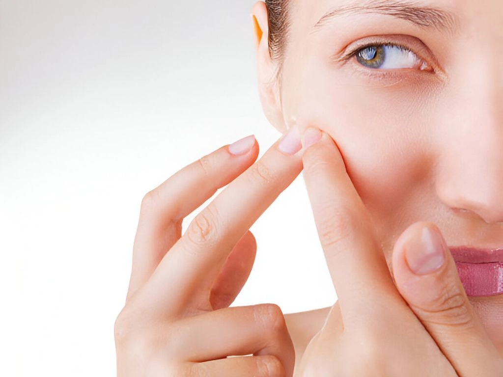 Isotretinoin kaufen